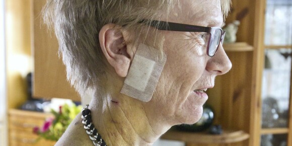Bente (59) ble knivstukket 17 ganger